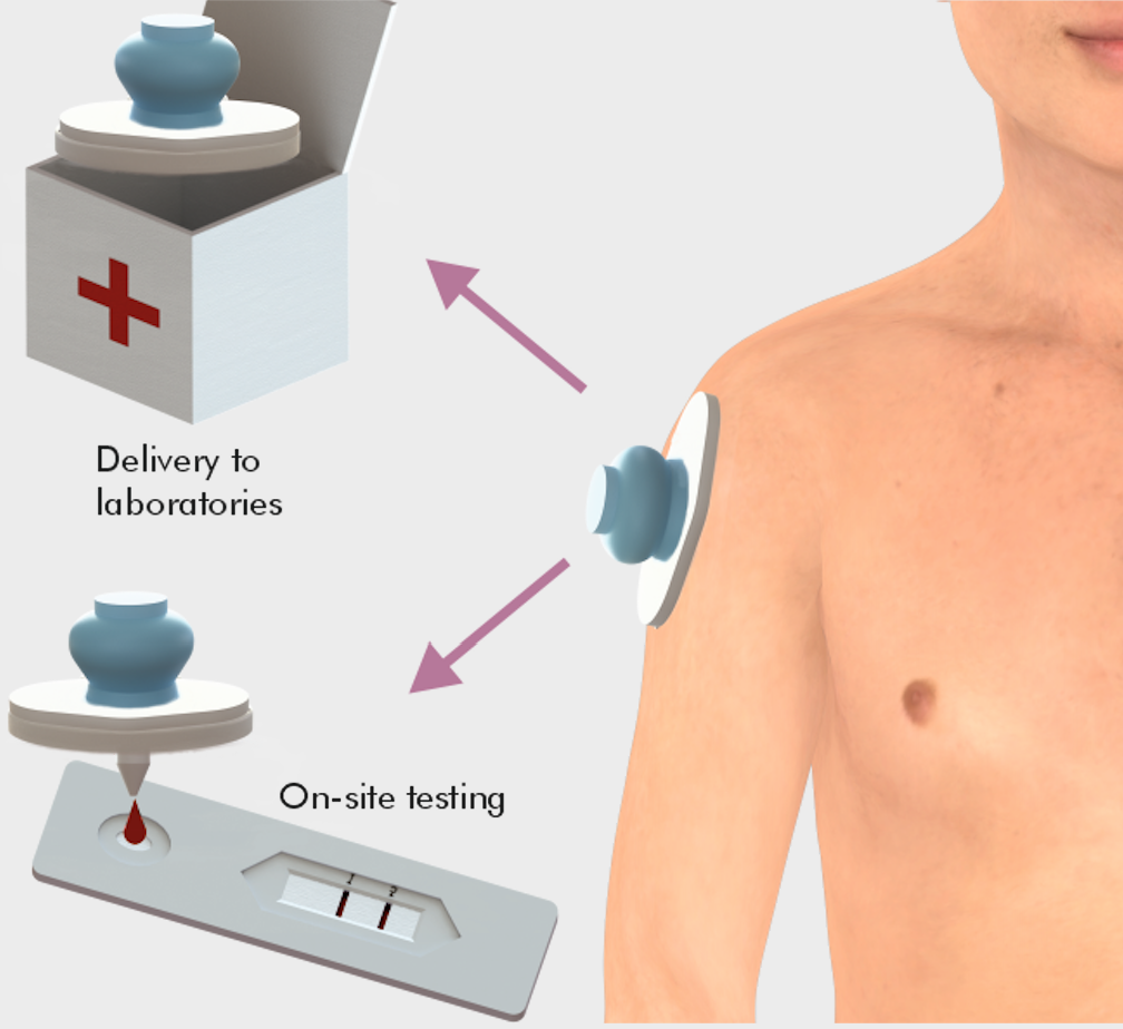 Nicole Zoratto blood sampling device